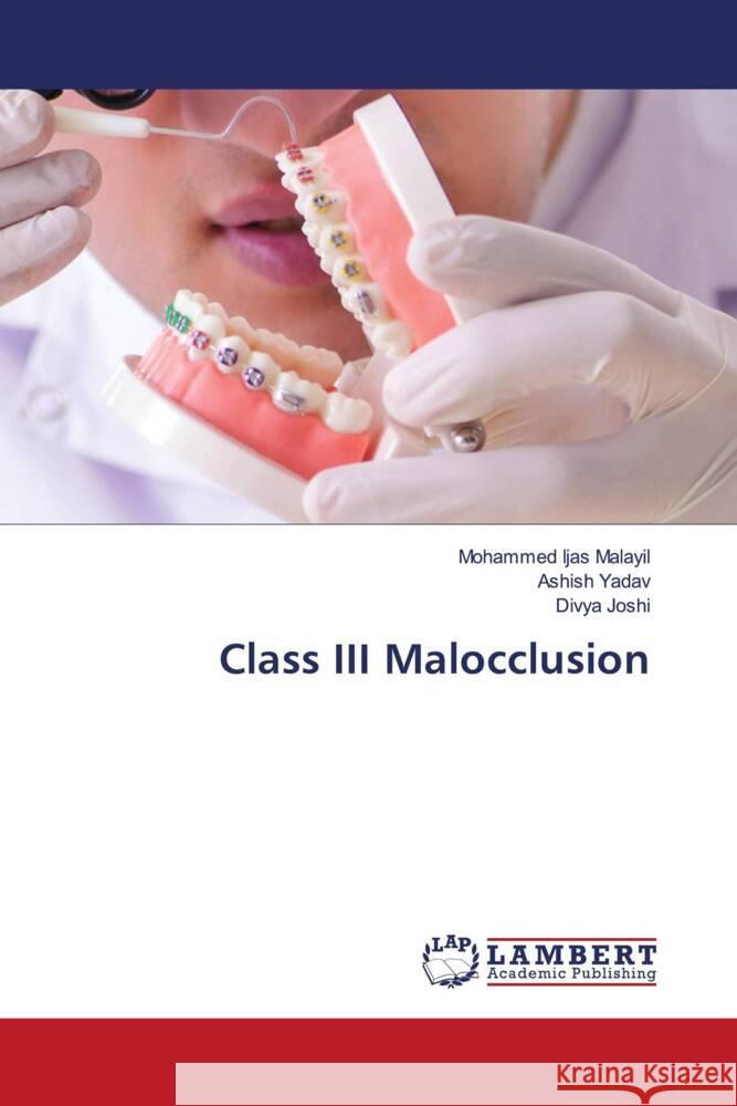 Class III Malocclusion Malayil, Mohammed Ijas, Yadav, Ashish, Joshi, Divya 9786139454365