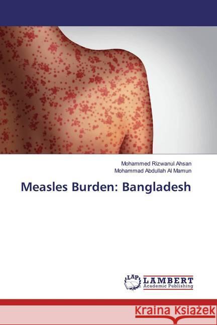 Measles Burden: Bangladesh Ahsan, Mohammed Rizwanul; Abdullah Al Mamun, Mohammad 9786139455546