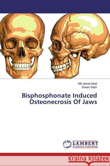 Bisphosphonate Induced Osteonecrosis Of Jaws Iqbal, Md.Jawed; Sabir, Sheeri 9786139461189