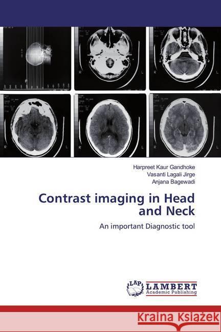 Contrast imaging in Head and Neck : An important Diagnostic tool Gandhoke, Harpreet Kaur; Jirge, Vasanti Lagali; Bagewadi, Anjana 9786139461752 LAP Lambert Academic Publishing