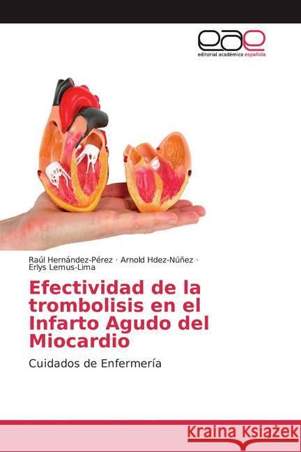 Efectividad de la trombolisis en el Infarto Agudo del Miocardio : Cuidados de Enfermería Hernández-Pérez, Raúl; Hdez-Núñez, Arnold; Lemus-Lima, Erlys 9786139465507 Editorial Académica Española