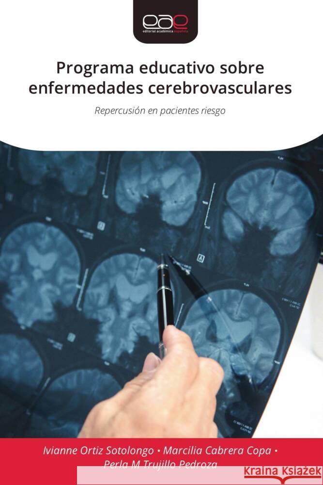 Programa educativo sobre enfermedades cerebrovasculares Ortiz Sotolongo, Ivianne, Cabrera Copa, Marcilia, Trujillo Pedroza, Perla M 9786139466009