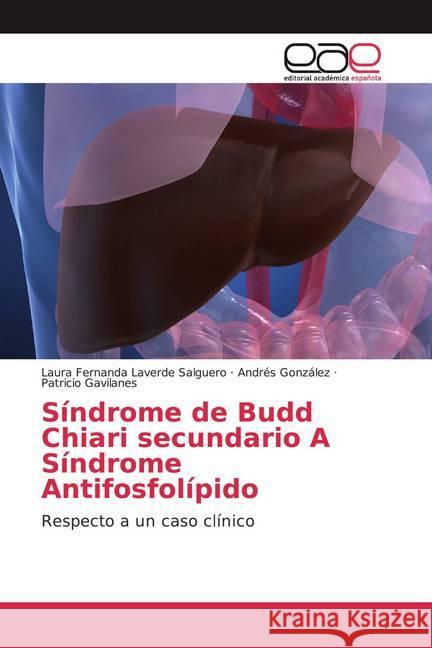 Síndrome de Budd Chiari secundario A Síndrome Antifosfolípido : Respecto a un caso clínico Laverde Salguero, Laura Fernanda; González, Andres; Gavilanes, Patricio 9786139468508