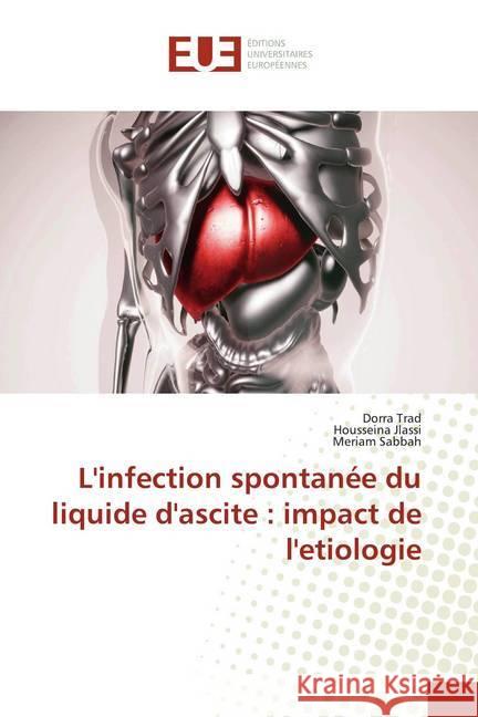 L'infection spontanée du liquide d'ascite : impact de l'etiologie Trad, Dorra; Jlassi, Housseina; Sabbah, Mériam 9786139510672