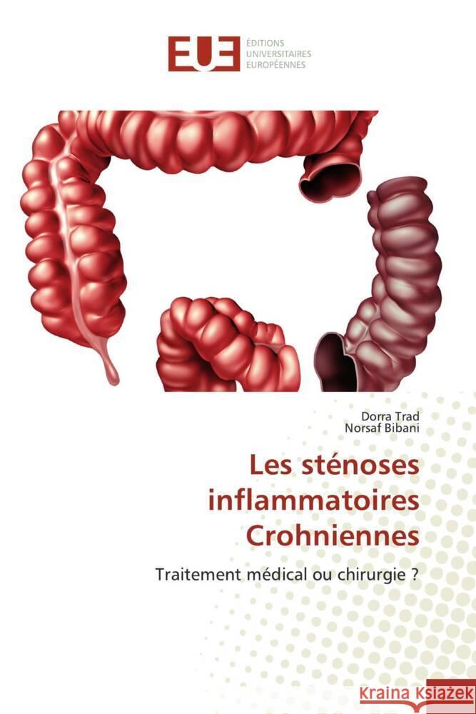 Les sténoses inflammatoires Crohniennes Trad, Dorra; BIBANI, Norsaf 9786139511594 Éditions universitaires européennes