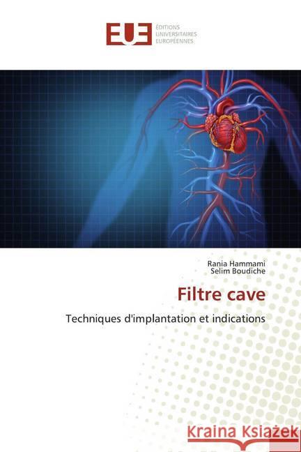 Filtre cave : Techniques d'implantation et indications HAMMAMI, Rania; Boudiche, Selim 9786139521692 Éditions universitaires européennes