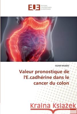 Valeur pronostique de l'E.cadhérine dans le cancer du colon Issam Msakni 9786139572878