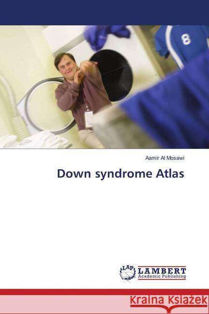 Down syndrome Atlas Al Mosawi, Aamir 9786139581207 LAP Lambert Academic Publishing