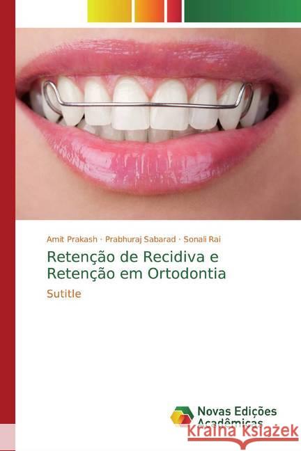 Retenção de Recidiva e Retenção em Ortodontia : Sutitle Prakash, Amit; Sabarad, Prabhuraj; Rai, Sonali 9786139611874 Novas Edicioes Academicas