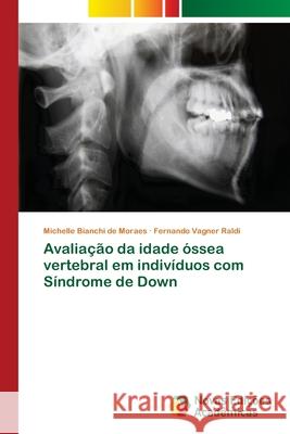 Avaliação da idade óssea vertebral em indivíduos com Síndrome de Down Bianchi de Moraes, Michelle; Vagner Raldi, Fernando 9786139614837