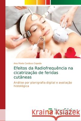 Efeitos da Radiofrequência na cicatrização de feridas cutâneas Cardoso Cepeda, Ana Maria 9786139635122 Novas Edicioes Academicas