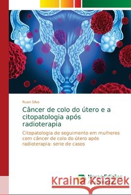 Câncer de colo do útero e a citopatologia após radioterapia Silva, Ruan 9786139644971