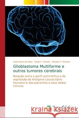 Glioblastoma Multiforme e outros tumores cerebrais Silva, Karla Rona Da 9786139648245