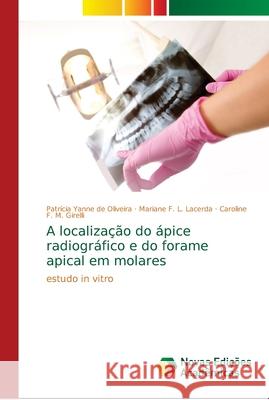 A localização do ápice radiográfico e do forame apical em molares de Oliveira, Patrícia Yanne 9786139650668 Novas Edicioes Academicas