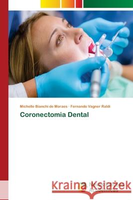 Coronectomia Dental Bianchi de Moraes, Michelle; Vagner Raldi, Fernando 9786139659333