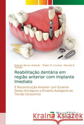 Reabilitação dentária em região anterior com Implante Imediato Barros Andrade, Roberta 9786139660407 Novas Edicioes Academicas