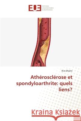 Athérosclérose et spondyloarthrite: quels liens? Dhahri, Rim 9786139733651 Éditions universitaires européennes