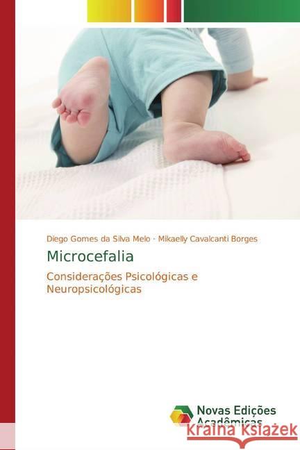 Microcefalia : Considerações Psicológicas e Neuropsicológicas Gomes da Silva Melo, Diego; Borges, Mikaelly Cavalcanti 9786139777303