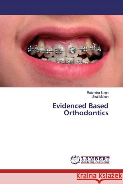 Evidenced Based Orthodontics Singh, Ratendra; Mohan, Stuti 9786139821051 LAP Lambert Academic Publishing