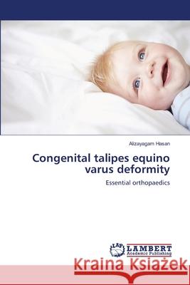 Congenital talipes equino varus deformity Hasan, Alizayagam 9786139829453