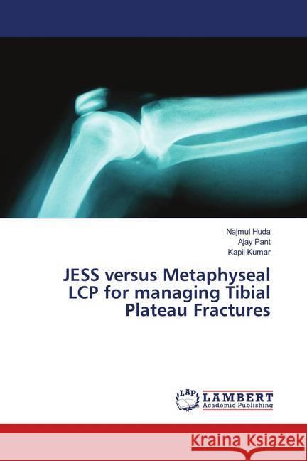 JESS versus Metaphyseal LCP for managing Tibial Plateau Fractures Huda, Najmul; Pant, Ajay; Kumar, Kapil 9786139832644 LAP Lambert Academic Publishing