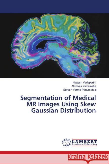 Segmentation of Medical MR Images Using Skew Gaussian Distribution Vadaparthi, Nagesh; Yarramalle, Srinivas; Penumatsa, Suresh Varma 9786139832828