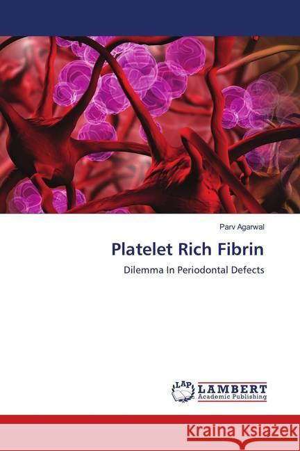 Platelet Rich Fibrin : Dilemma In Periodontal Defects Agarwal, Parv 9786139834167