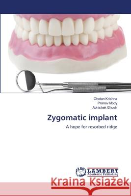 Zygomatic implant Krishna, Chetan 9786139840052 LAP Lambert Academic Publishing