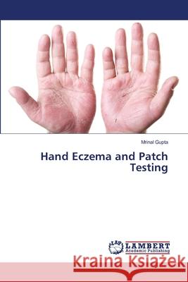 Hand Eczema and Patch Testing Gupta, Mrinal 9786139844661