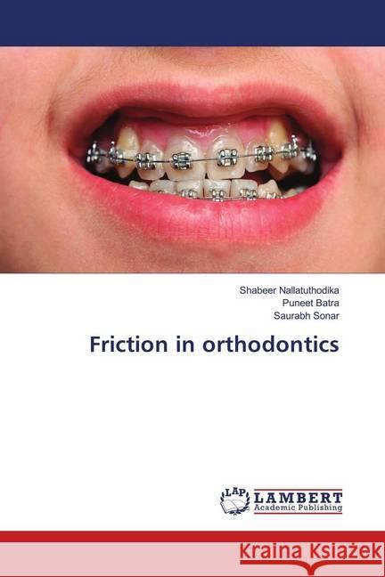 Friction in orthodontics Nallatuthodika, Shabeer; Batra, Puneet; Sonar, Saurabh 9786139871582