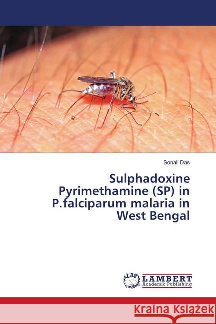 Sulphadoxine Pyrimethamine (SP) in P.falciparum malaria in West Bengal Das, Sonali 9786139875306 LAP Lambert Academic Publishing