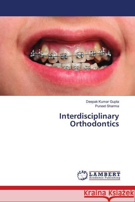 Interdisciplinary Orthodontics Kumar Gupta, Deepak; Sharma, Puneet 9786139875320