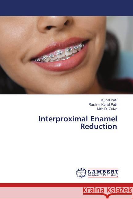 Interproximal Enamel Reduction Patil, Kunal; Patil, Rashmi Kunal; Gulve, Nitin D. 9786139876730