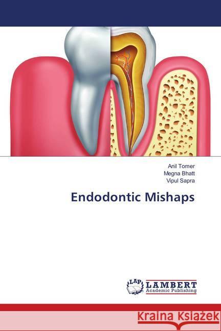 Endodontic Mishaps Tomer, Anil; Bhatt, Megna; Sapra, Vipul 9786139891351 LAP Lambert Academic Publishing