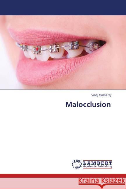 Malocclusion Somaraj, Vinej 9786139891399