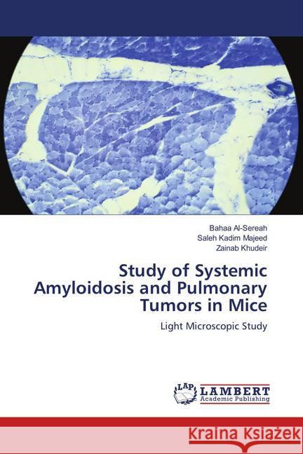 Study of Systemic Amyloidosis and Pulmonary Tumors in Mice : Light Microscopic Study Al-Sereah, Bahaa; Kadim Majeed, Saleh; khudeir, Zainab 9786139895397 LAP Lambert Academic Publishing