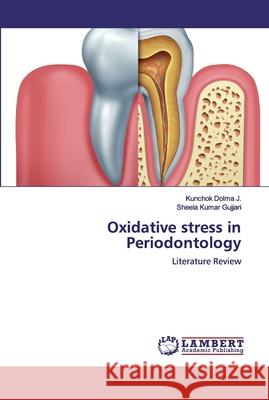 Oxidative stress in Periodontology Dolma J., Kunchok 9786139897872 LAP Lambert Academic Publishing