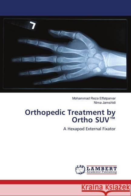 Orthopedic Treatment by Ortho SUV(TM) : A Hexapod External Fixator Effatparvar, Mohammad Reza; Jamshidi, Nima 9786139913138