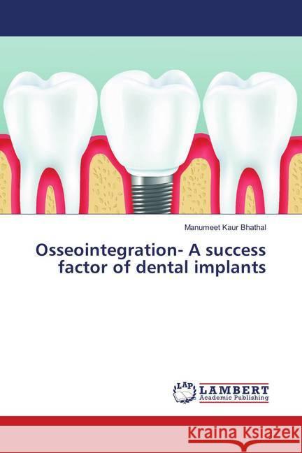 Osseointegration- A success factor of dental implants Bhathal, Manumeet Kaur 9786139913633