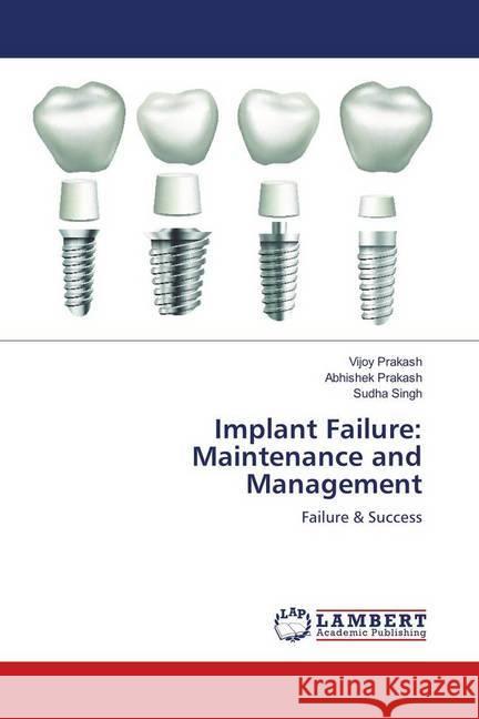 Implant Failure: Maintenance and Management : Failure & Success Prakash, Vijoy; Prakash, Abhishek; Singh, Sudha 9786139916573 LAP Lambert Academic Publishing