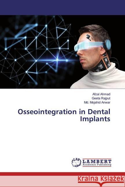 Osseointegration in Dental Implants Ahmad, Afzal; Rajput, Geeta; Anwar, Md. Mojahid 9786139928927