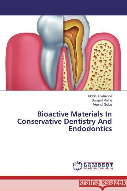 Bioactive Materials In Conservative Dentistry And Endodontics Lokhande, Mohini; Kolhe, Swapnil; Gulve, Meenal 9786139944606 LAP Lambert Academic Publishing