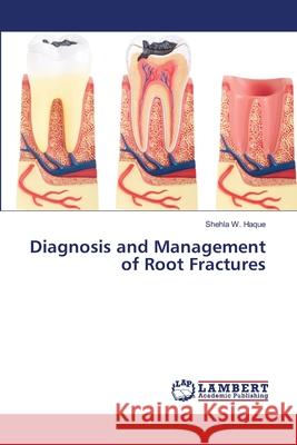 Diagnosis and Management of Root Fractures W. Haque, Shehla 9786139995684 LAP Lambert Academic Publishing