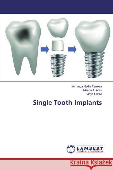 Single Tooth Implants Ferreira, Amanda Nadia; Aras, Meena A.; Chitre, Vidya 9786200007216