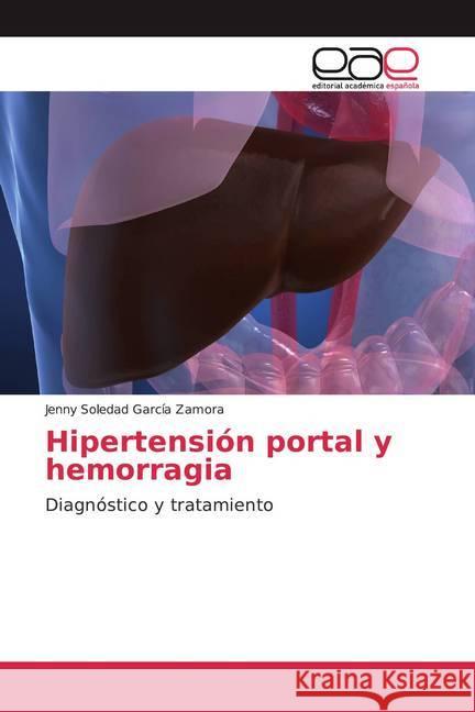 Hipertensión portal y hemorragia : Diagnóstico y tratamiento García Zamora, Jenny Soledad 9786200038487