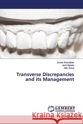 Transverse Discrepancies and its Management Khandekar, Suhas; Nehete, Amit; Gulve, Nitin 9786200080837 LAP Lambert Academic Publishing