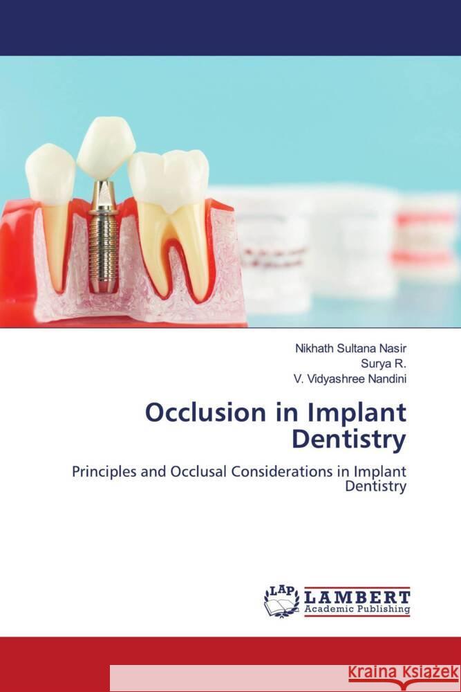 Occlusion in Implant Dentistry Sultana Nasir, Nikhath, R., Surya, Nandini, V. Vidyashree 9786200091161