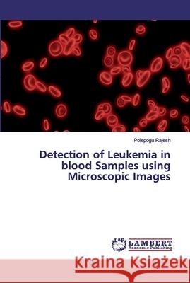 Detection of Leukemia in blood Samples using Microscopic Images Rajesh, Polepogu 9786200091628 LAP Lambert Academic Publishing