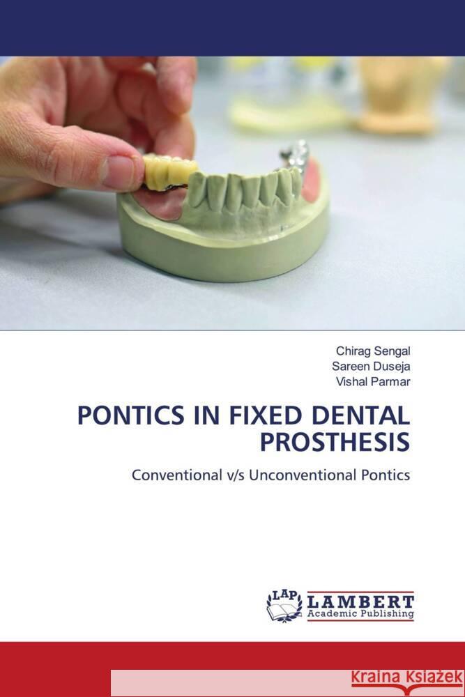 PONTICS IN FIXED DENTAL PROSTHESIS Sengal, Chirag, Duseja, Sareen, Parmar, Vishal 9786200093912