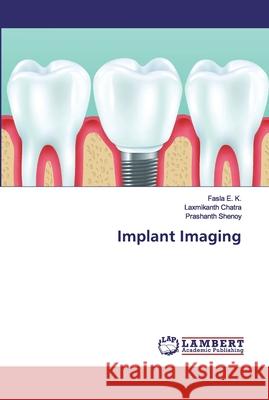 Implant Imaging E. K., Fasla; Chatra, Laxmikanth; Shenoy, Prashanth 9786200095695 LAP Lambert Academic Publishing